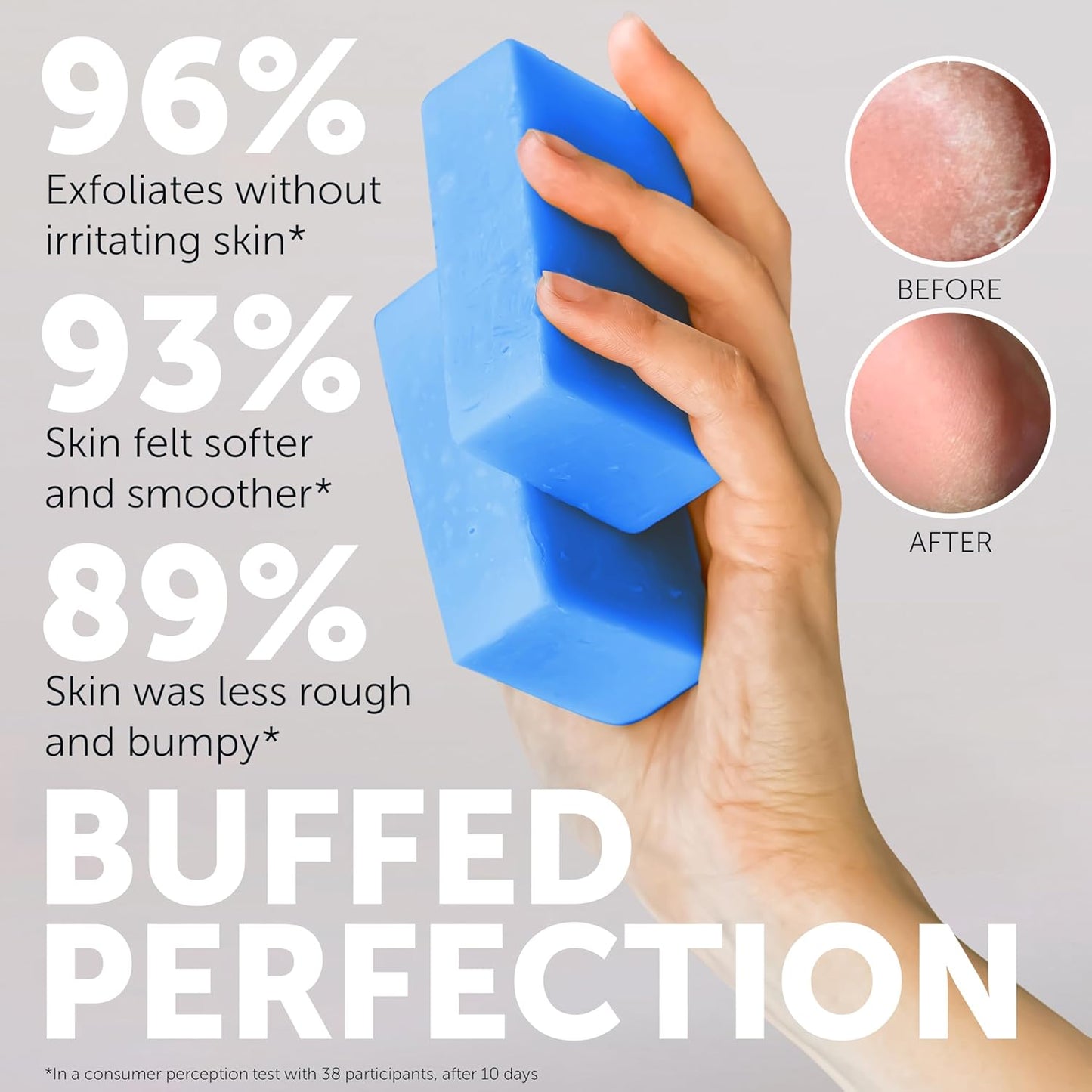 Jabón corporal para queratosis pilaris | Jabón exfoliante con 10% A...