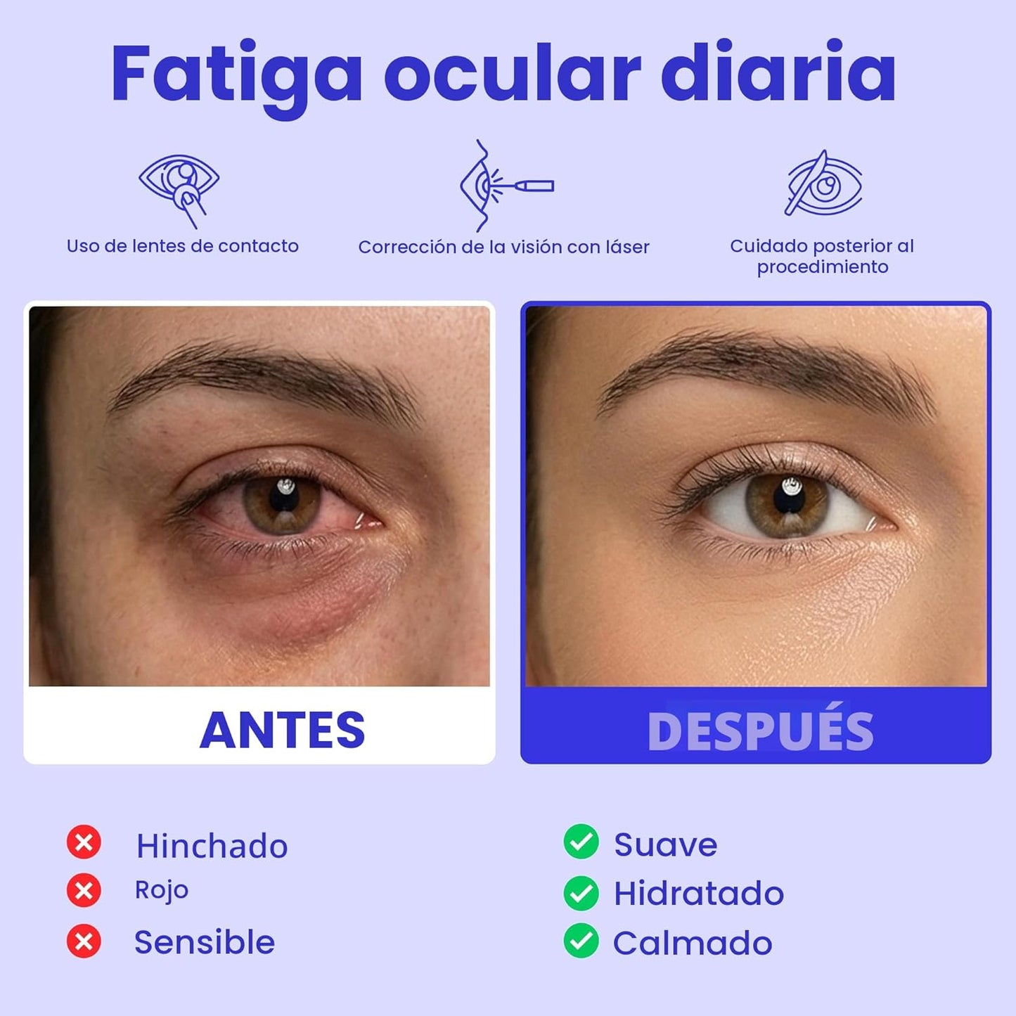Compresa Térmica Autocalentable para Ojos Secos, Máscara de Vapor p...