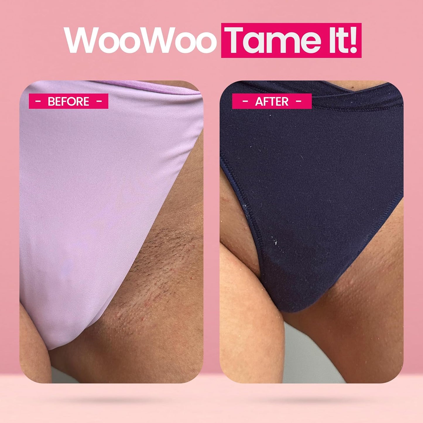 WooWoo Crema natural de depilación íntima - Removedor de pelo vegan...