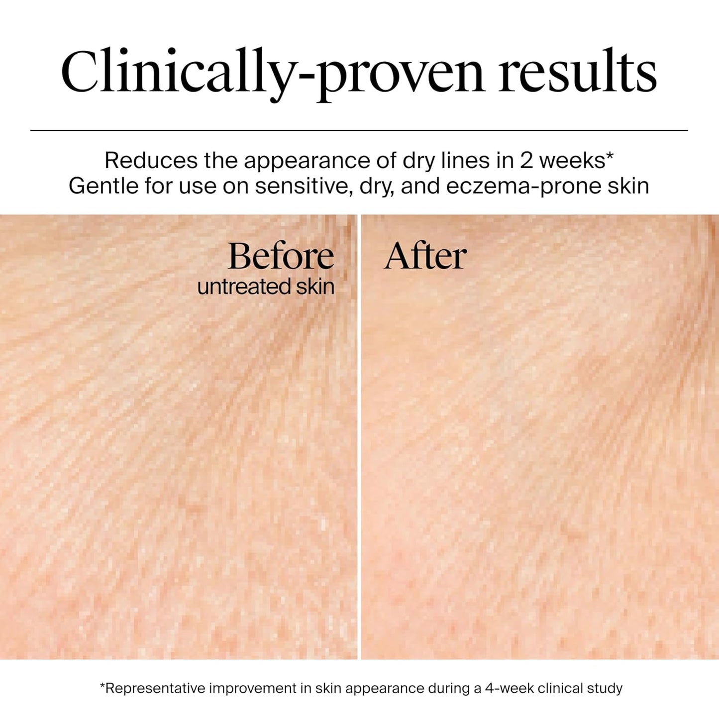 Neutrogena Hydro Boost Gel Cream, hidratación de 48 horas para piel...