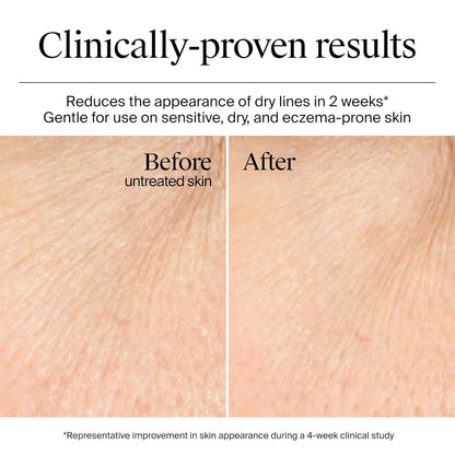 Neutrogena Hydro Boost Gel Cream, hidratación de 48 horas para piel...