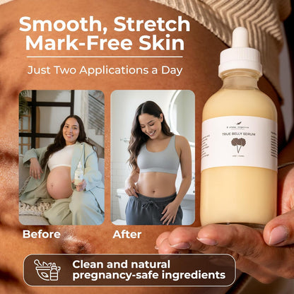 8 Sheep True Belly Serum, aceite para el vientre seguro para el embarazo con ácido hialurónico de triple peso y centella asiática, apoya la hidratación y elasticidad de la piel, fabricado en Estados