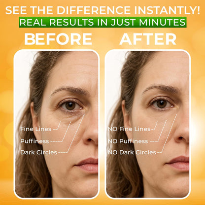 Tratamiento para ojos hinchados Resultados instantáneos \u2013 Elim...