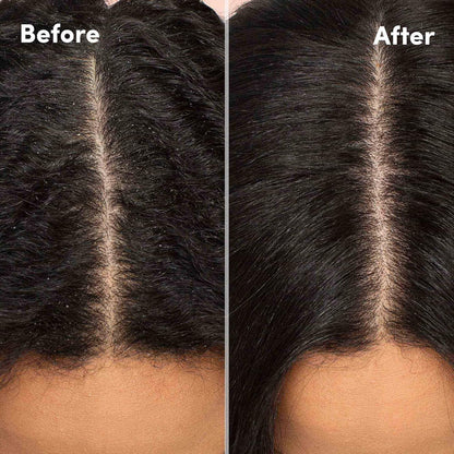Mizani Scalp Care Loción calmante para el cuero cabelludo | Tratamiento de la caspa | Nutre y calma el cuero cabelludo | Para cabello rizado | 4 onzas líquidas