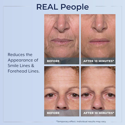 Plexaderm Suero de ojos de reducción rápida: reduce visiblemente la...
