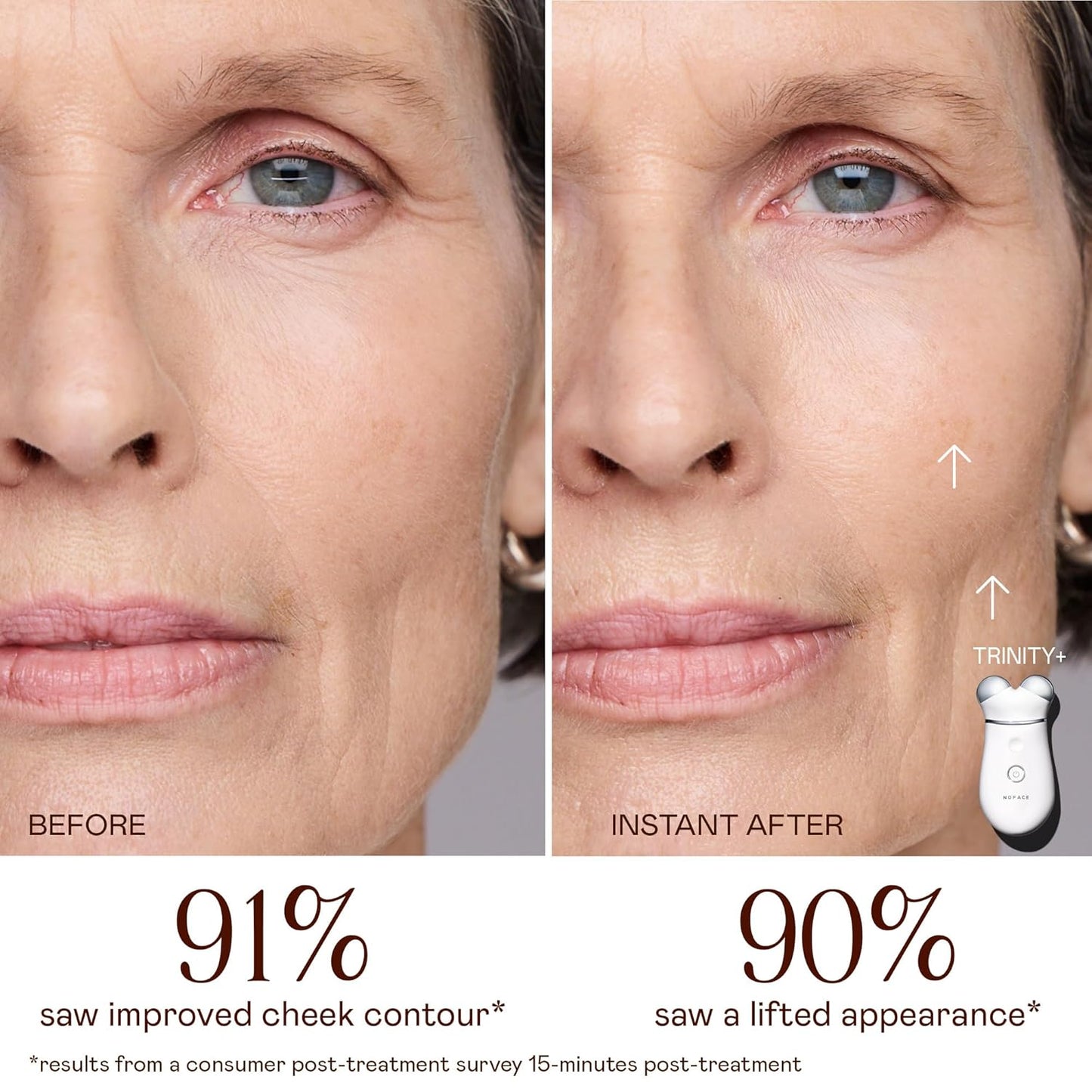 NuFACE Trinity+ Kit de Dispositivo Facial de Microcorriente \u2013...