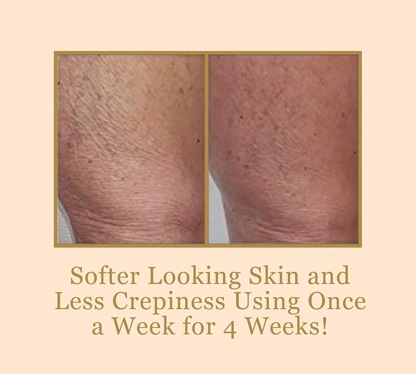 Bee Stunning DIAMONDBUFF Microderm - Herramienta de exfoliación \u2...