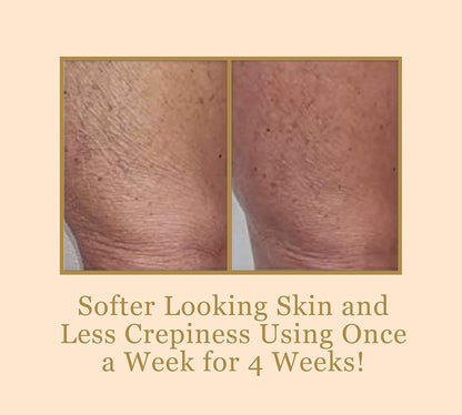 Bee Stunning DIAMONDBUFF Microderm - Herramienta de exfoliación \u2...