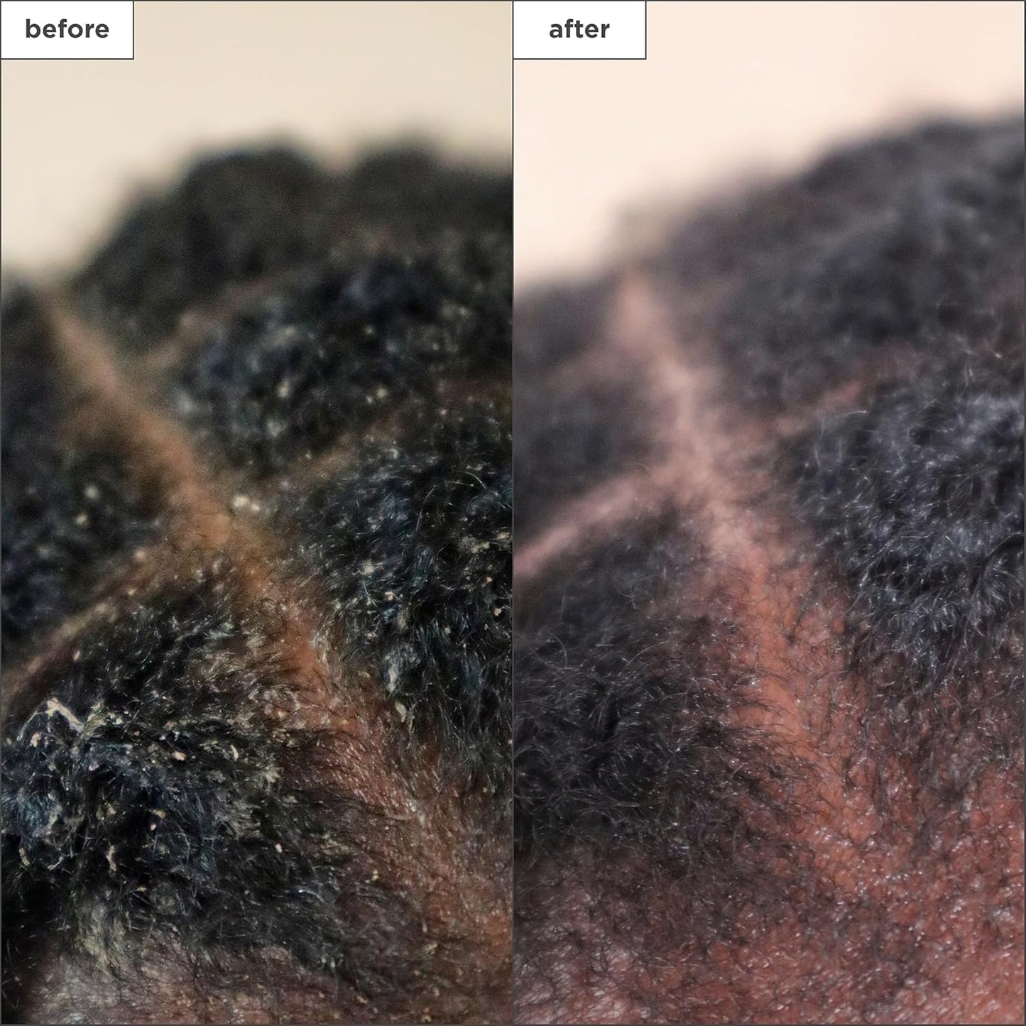 Briogeo Scalp Revival - Tratamiento para el cuero cabelludo con carbón y árbol de té, suero sin enjuague para cuero cabelludo seco, escamoso o con picazón, hidratante y equilibrante, vegano y libre de crueldad, 1 onza