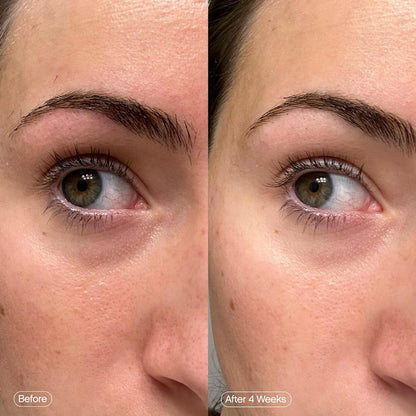 Topicals Faded Máscaras Iluminadoras para Debajo de los Ojos | Parches para Desinflar, Hidratar, Iluminar y Enfriar | Reduce las Ojeras y Líneas Finas | Contiene Ácido Kójico, Cafeína y Niacinamida