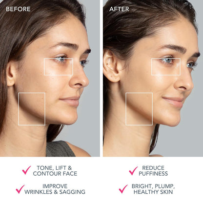 FOREO Bear 2 Dispositivo facial de microcorriente de tonificación a...