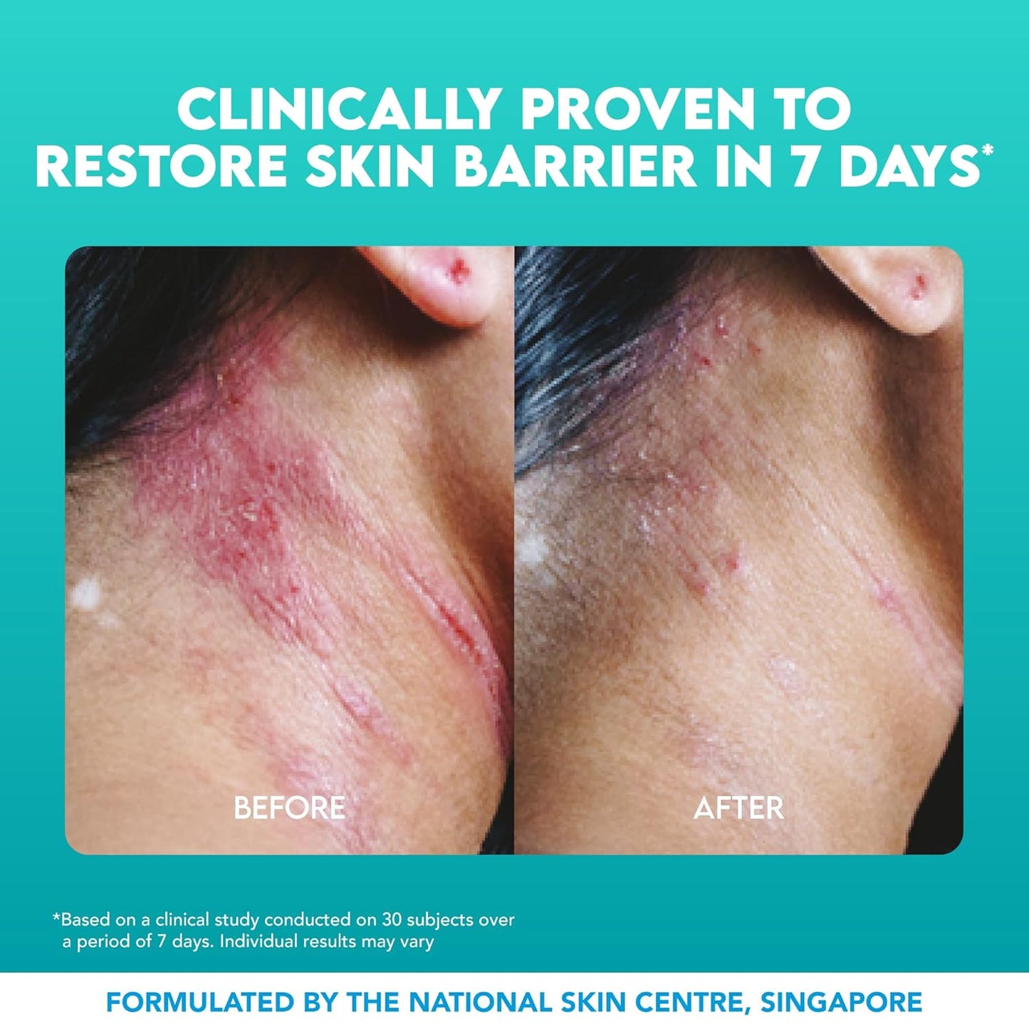 Suu Balm Crema intensa para aliviar la picazón, loción antipicazón para pieles sensibles, eczema, psoriasis y piel extrema, muy grave y seca, fórmula Derm, mentol y ceramidas, 11.83 onzas líquidas