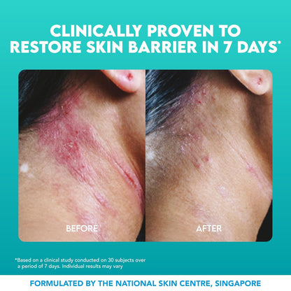 Suu Balm Crema intensa para aliviar la picazón, loción antipicazón para pieles sensibles, eczema, psoriasis y piel extrema, muy grave y seca, fórmula Derm, mentol y ceramidas, 11.83 onzas líquidas