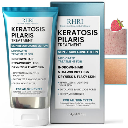 Tratamiento de queratosis pilaris | Loción de queratosis pilaris co...