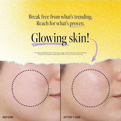Aceite Facial Derma E Vitamina C Glow, 1 Fl Oz, Nutre, Ilumina y Brilla para una Piel Radiante, Aceite Hidratante de Vitamina C con Cúrcuma, Espino Amarillo y Frambuesa Roja