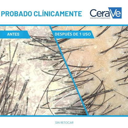 CeraVe Champú hidratante anticaspa, tratamiento de caspa de zinc pi...