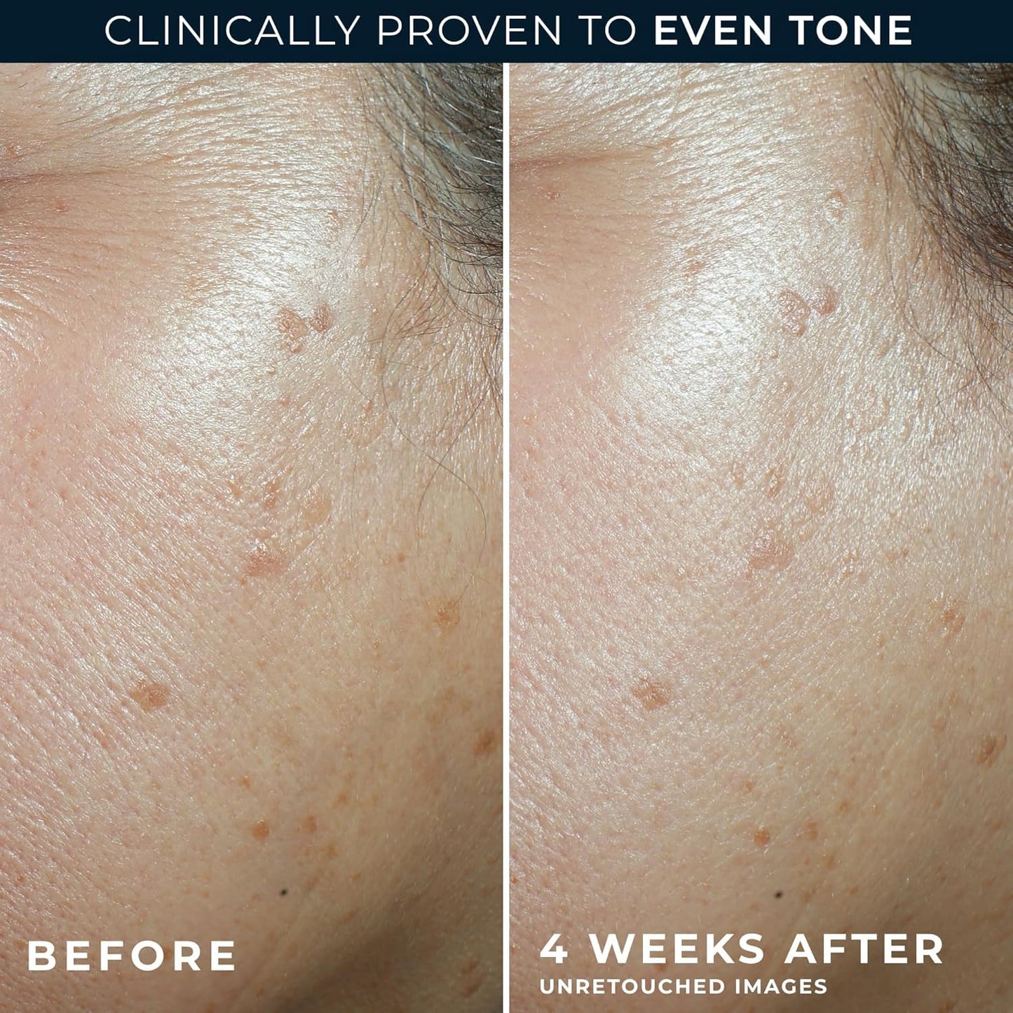 RoC Multi Correxion 5 en 1 hidratante facial diario antienvejecimie...