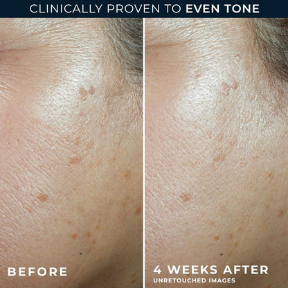 RoC Multi Correxion 5 en 1 hidratante facial diario antienvejecimie...