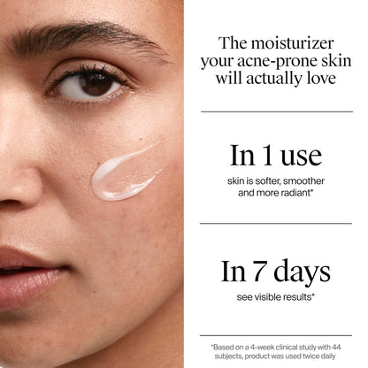 Neutrogena Hidratante de gel para acné uniformemente transparente con ácido salicílico y N-acetil glucosamina, hidratante facial ligero y no grasoso que ayuda a tratar brotes y desvanecer visiblemente