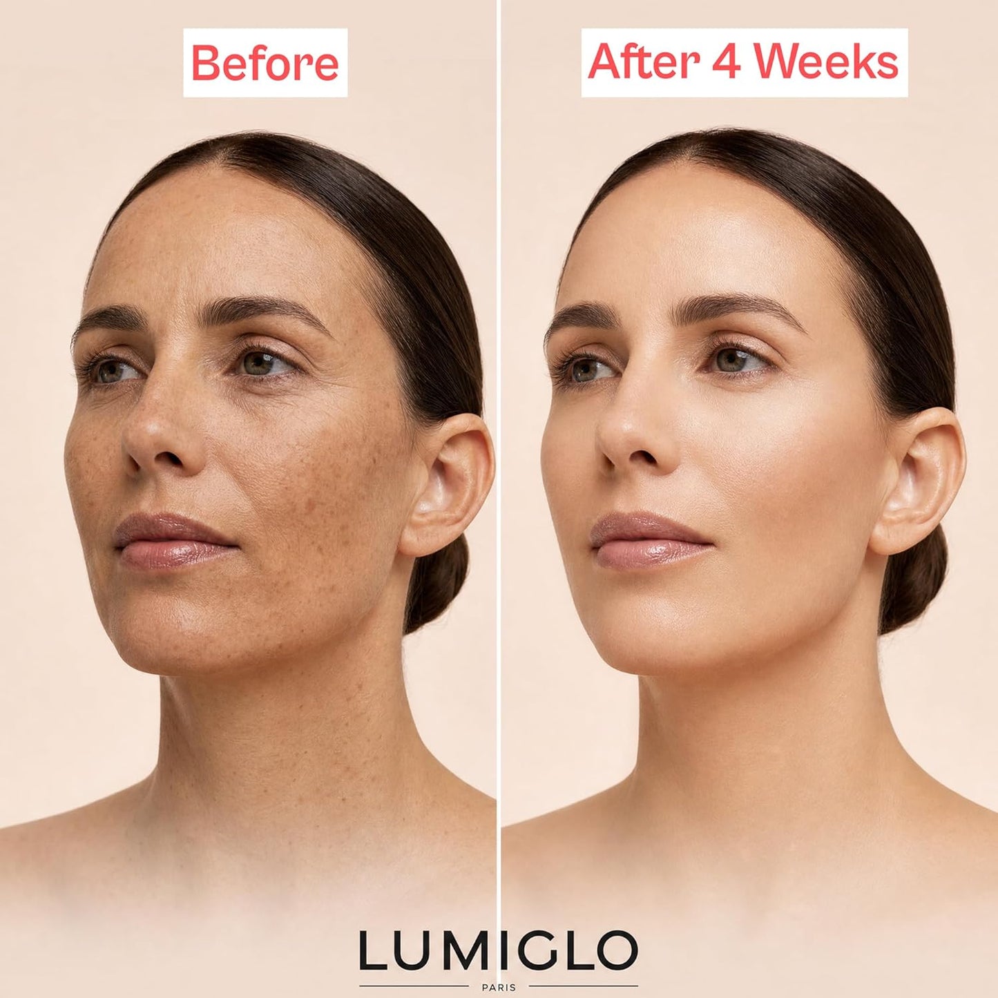 Lumiglo París - Máscara facial de terapia de luz LED, luz roja, dis...