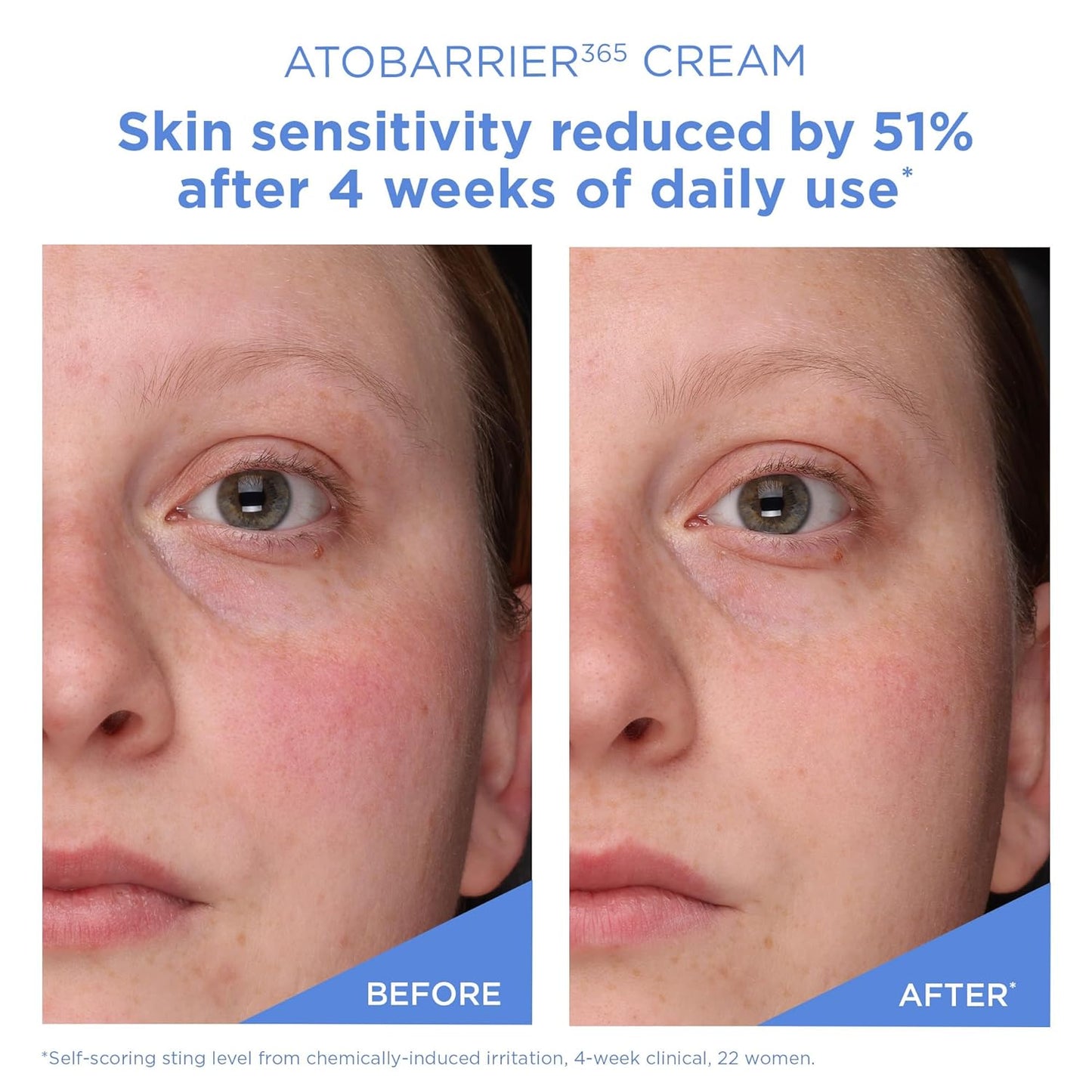 AESTURA ATOBARRIER365 Crema con Ceramidas, Hidratante Facial Coreano para Reparación de la Barrera | Hidratación Duradera de 120H, Cápsulas de Ceramidas, Para Piel Seca y Sensible, No comedogénica, 80