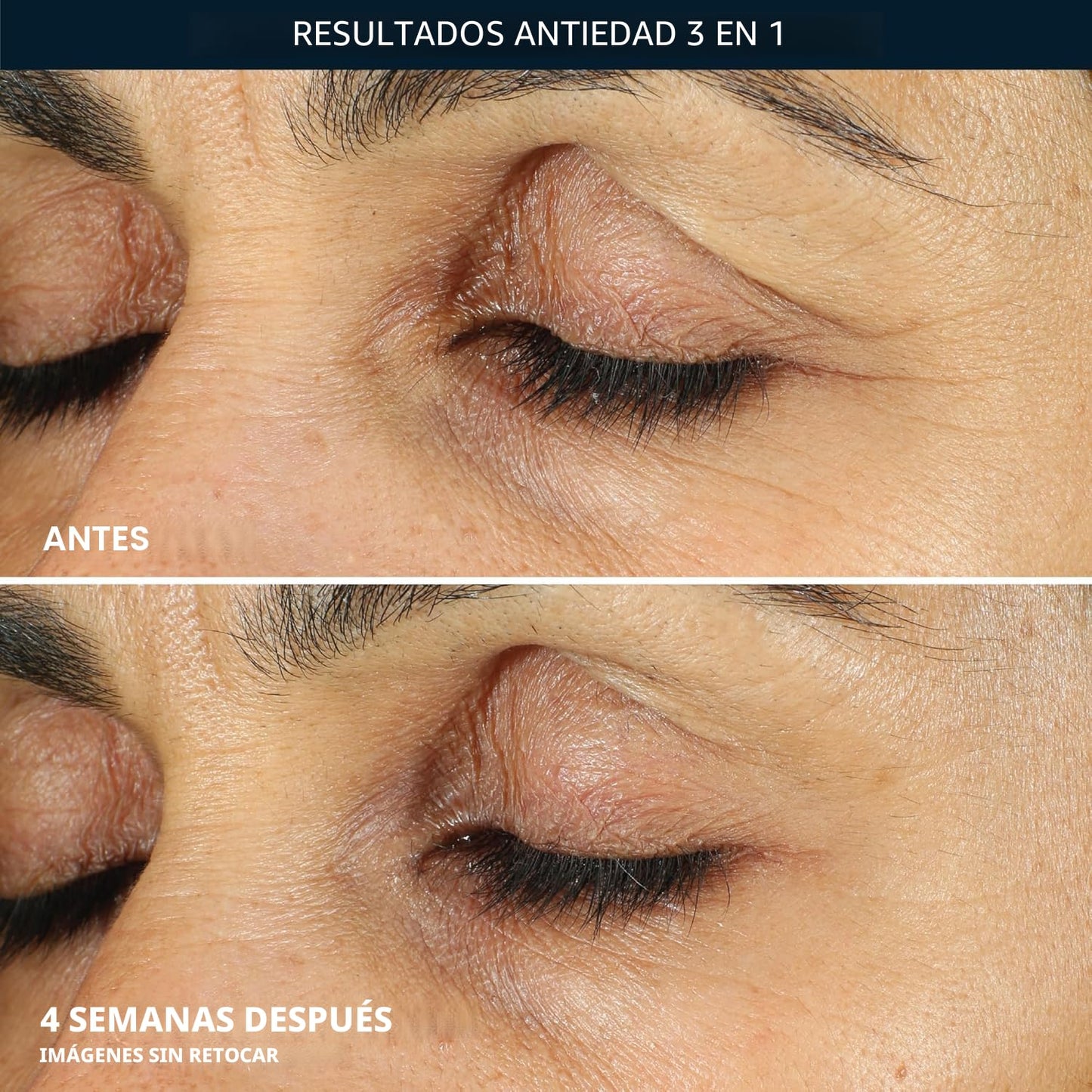 RoC Retinol Correxion - Crema para debajo de los ojos para ojeras y...