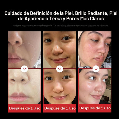Medicube Age-R Booster Pro | 6-en-1 masajeador de belleza con vidri...
