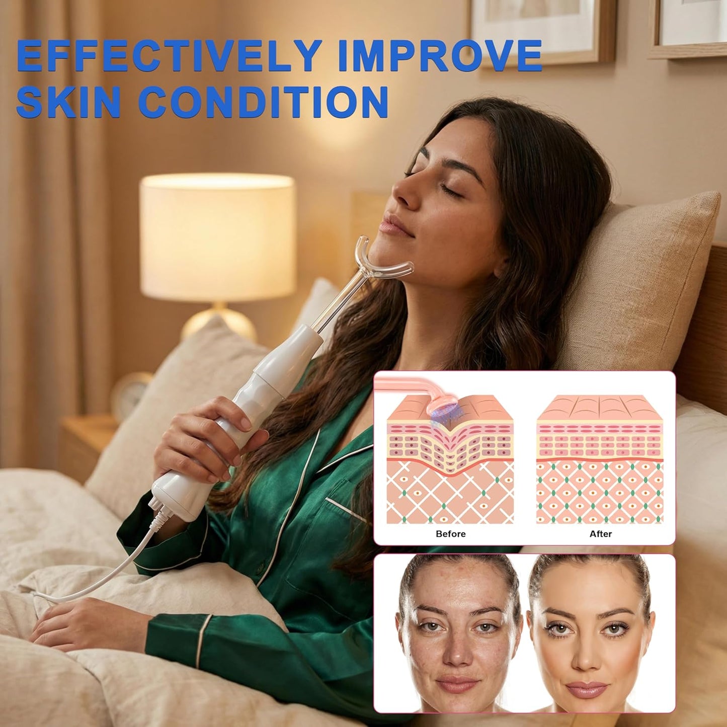 Elitzia ETSC640B herramienta de cuidado facial de alta frecuencia d...