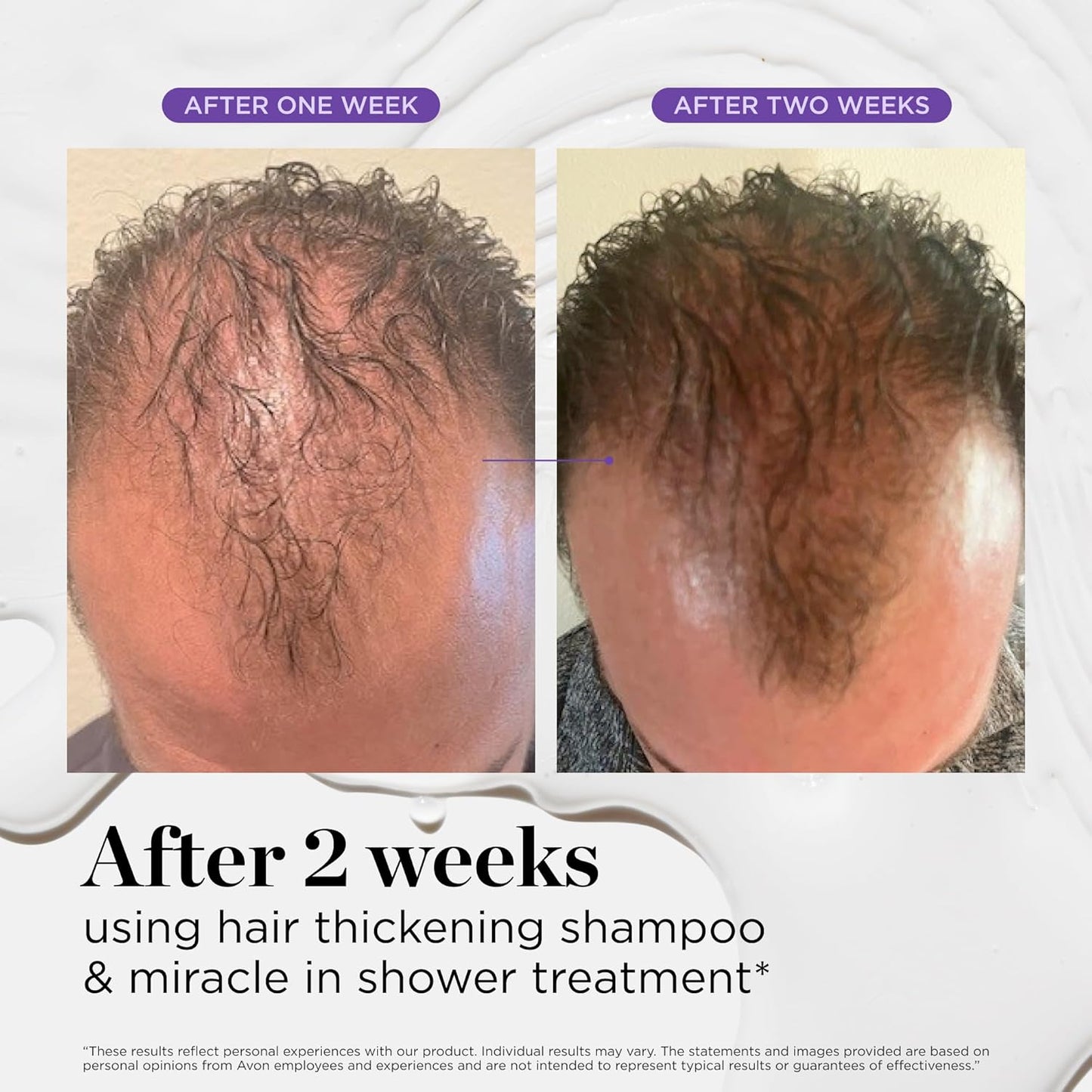 Dr. Groot Miracle in Shower - Tratamiento hidratante para la pérdida del cabello, enjuague coreano para el cuidado del cabello, aceite de romero para un cabello suave y saludable en 5 segundos, solución revitalizante del cuero cabelludo