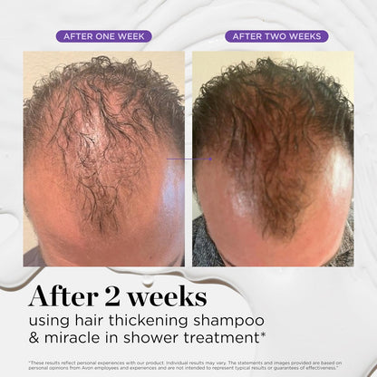 Dr. Groot Miracle in Shower - Tratamiento hidratante para la pérdida del cabello, enjuague coreano para el cuidado del cabello, aceite de romero para un cabello suave y saludable en 5 segundos, solución revitalizante del cuero cabelludo