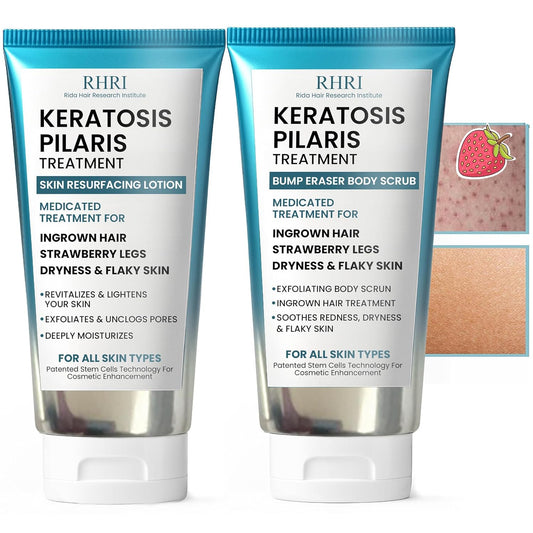 KP Bump Eraser Body Set con 10% AHA | Tratamiento de queratosis pil...