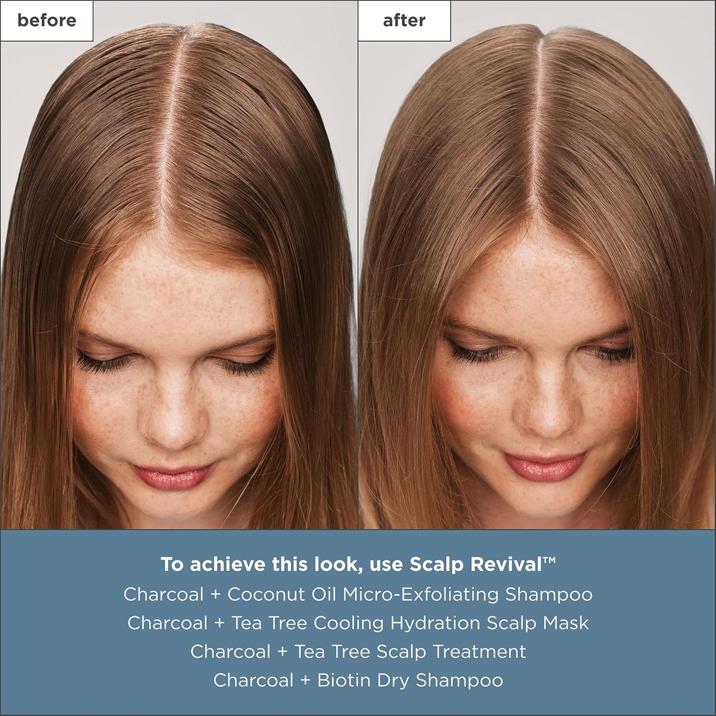 Briogeo Scalp Revival - Tratamiento para el cuero cabelludo con carbón y árbol de té, suero sin enjuague para cuero cabelludo seco, escamoso o con picazón, hidratante y equilibrante, vegano y libre de crueldad, 1 onza