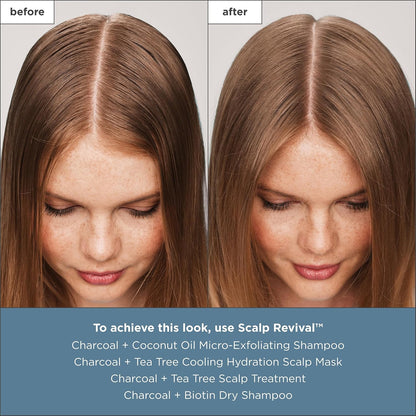 Briogeo Scalp Revival - Tratamiento para el cuero cabelludo con carbón y árbol de té, suero sin enjuague para cuero cabelludo seco, escamoso o con picazón, hidratante y equilibrante, vegano y libre de crueldad, 1 onza