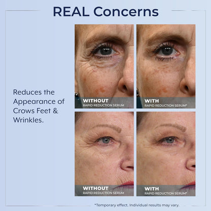 Plexaderm Suero de ojos de reducción rápida: reduce visiblemente la...