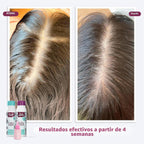 D'Luchi Kit de tratamiento capilar para crecimiento y cuidado i...