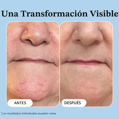 Vibriance Súper C Suero para Piel Madura - Fórmula de Vitamina Todo...