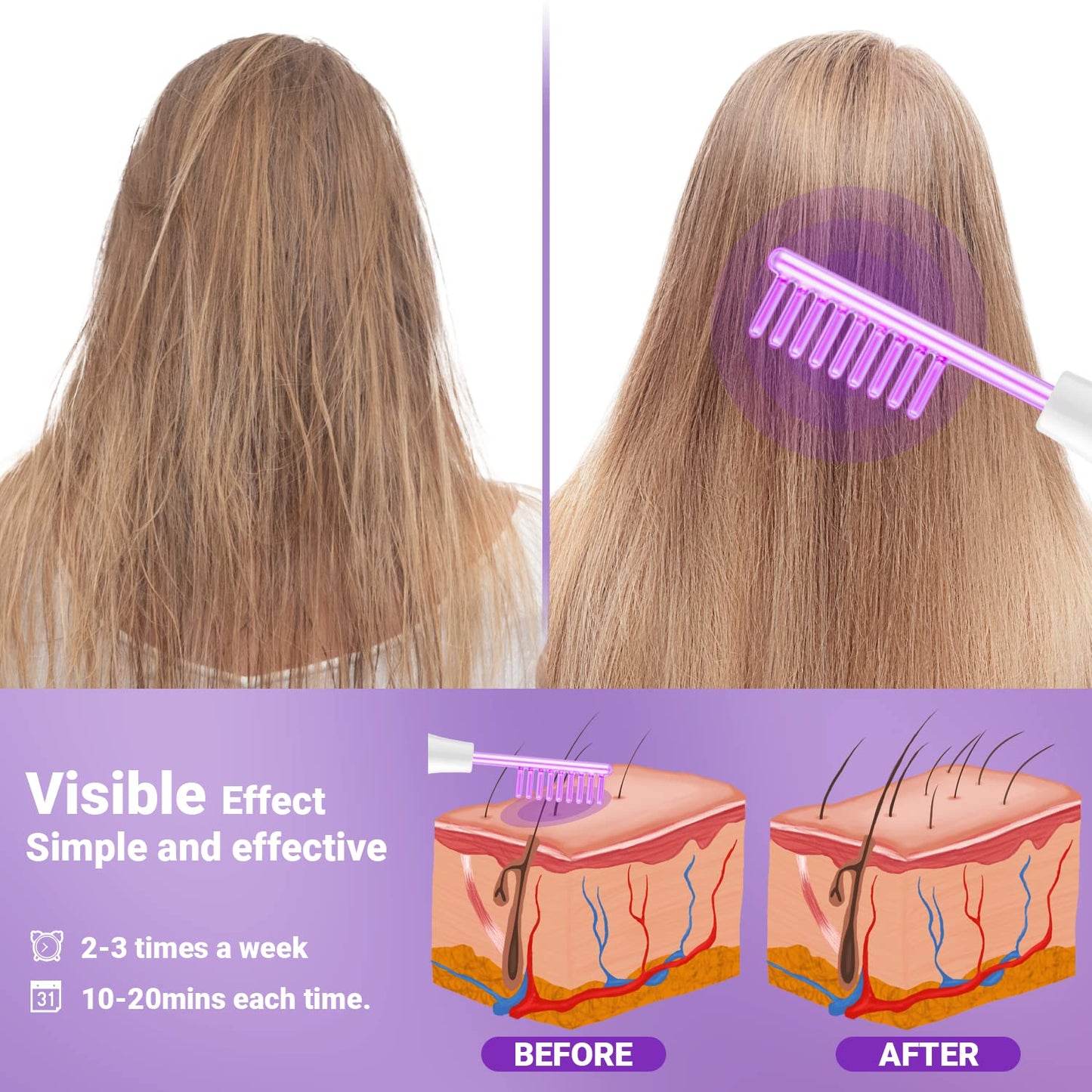 Varita Facial de Alta Frecuencia-UUPAS Máquina Facial Portátil de M...