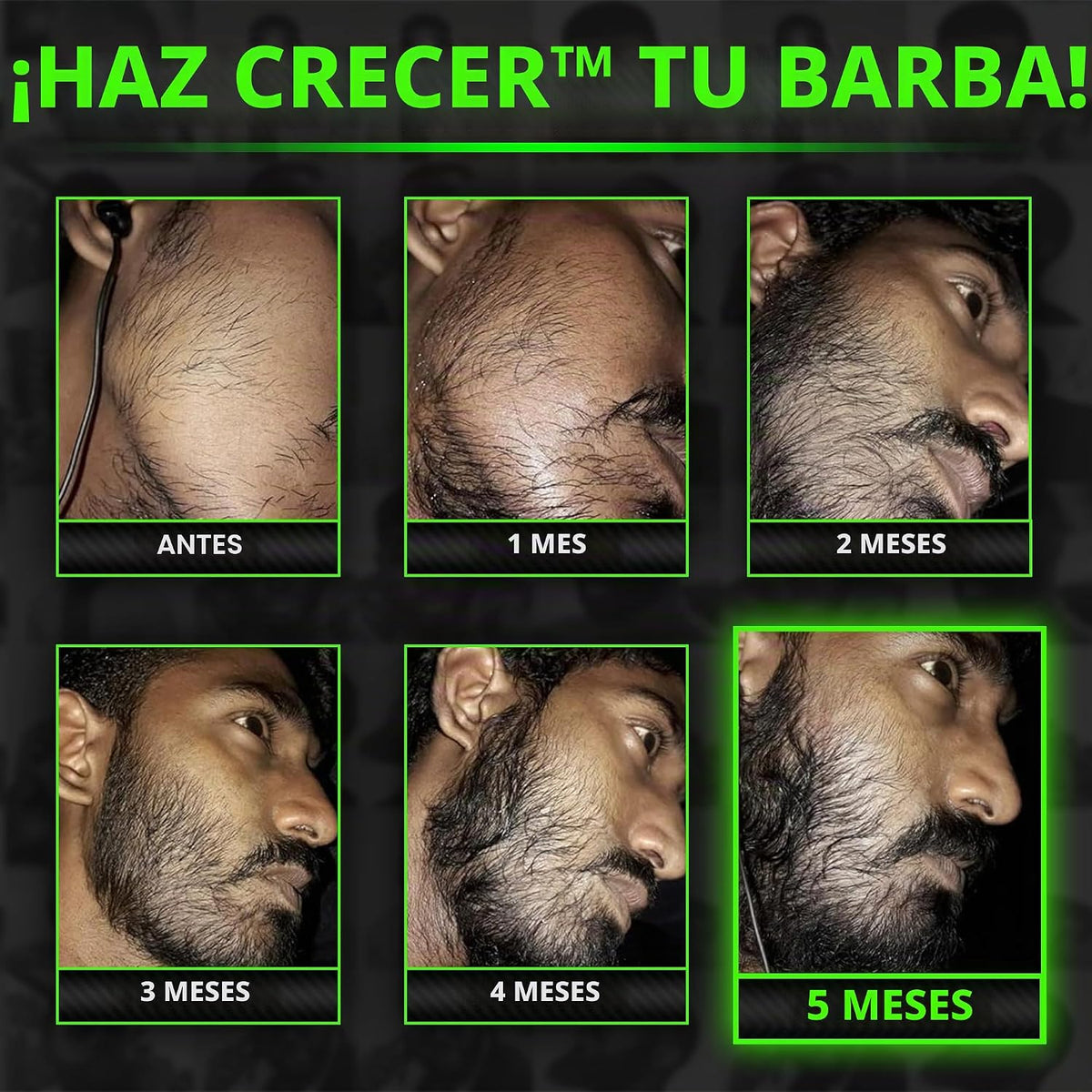 GROW XXL - Paquete de crecimiento de barba - Aceite de crecimiento...