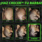 Beard GROW XXL y paquete de minoxidil para barba para hombres, acei...
