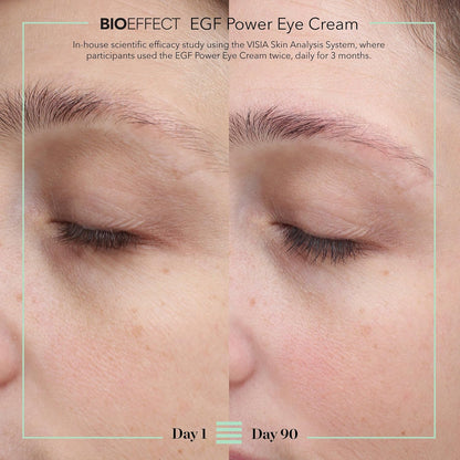 BIOEFFECT EGF Power Eye Cream | Tratamiento intensivo de ojos que d...