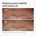 The Ordinary Set favorito de suero – Ácido hialurónico 2% + B5, niacinamida 10% + zinc 1%, solución de cafeína 5% – Sueros para ojos y cara para hidratar, aclarar y minimizar los poros cuidado de la piel