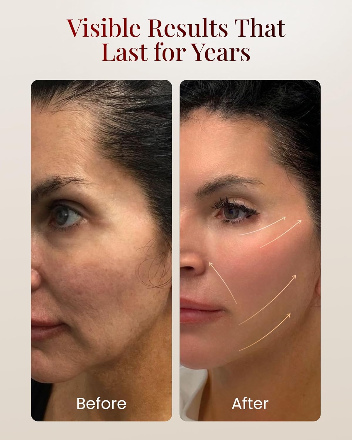 BeautyOnBoard Herramienta de masajeador facial, herramienta de escu...