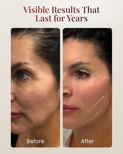 BeautyOnBoard Herramienta de masajeador facial, herramienta de escu...