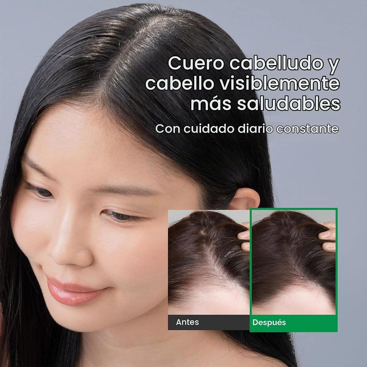 Spray de suero para el cuero cabelludo y ampolla capilar Cuidado de...
