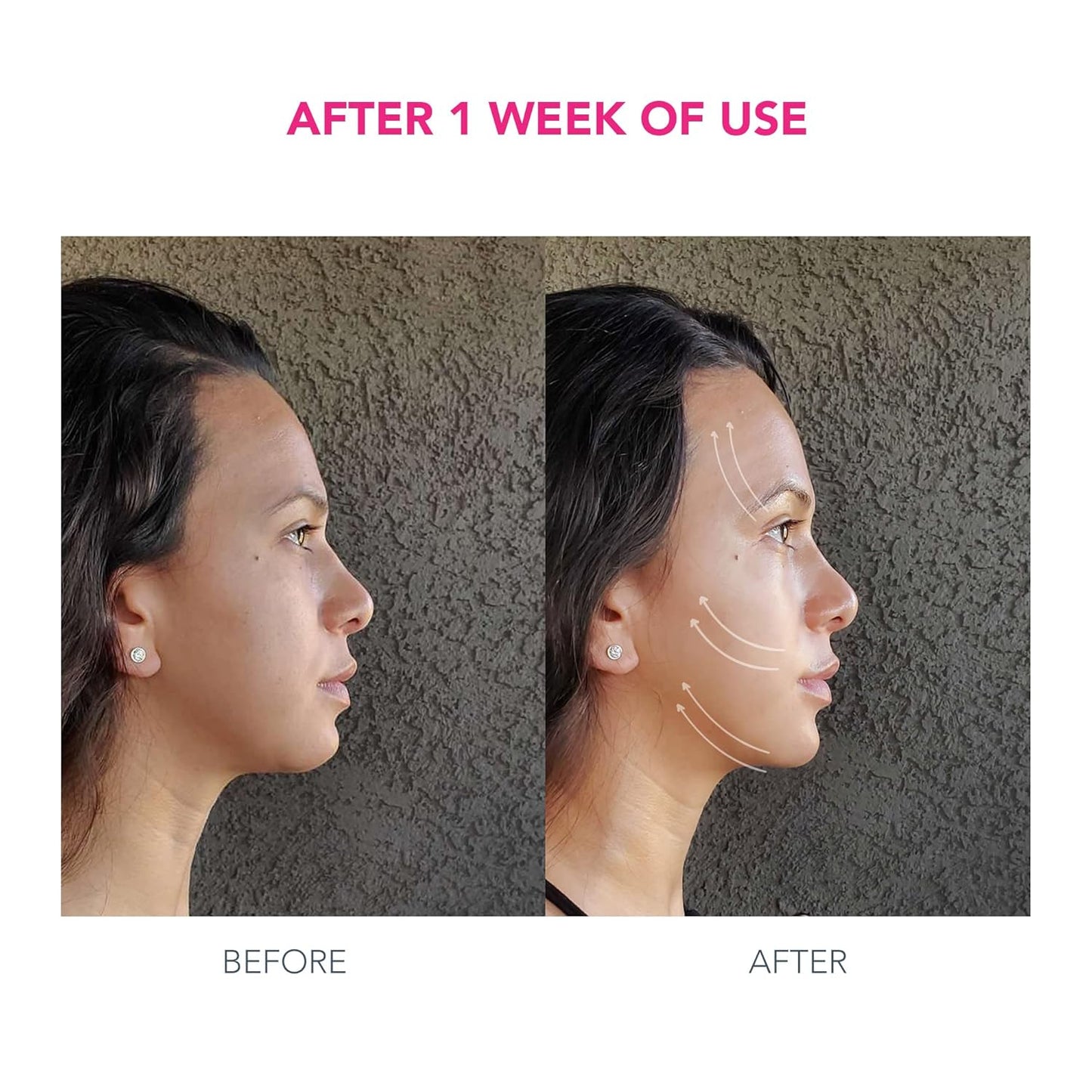FOREO Paquete Bear Desafiante de la Edad - Dispositivo Facial de Mi...