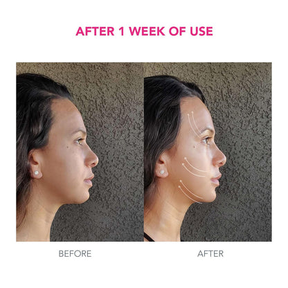 FOREO Paquete Bear Desafiante de la Edad - Dispositivo Facial de Mi...
