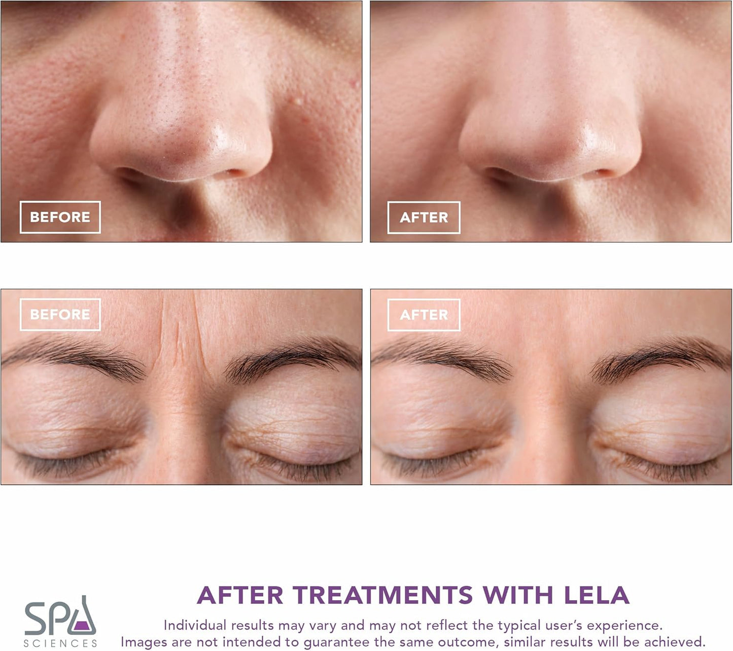 Spa Sciences - LELA - Espátula facial 4 en 1 para limpieza profunda...