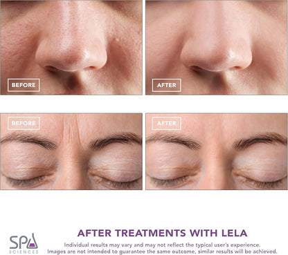 Spa Sciences - LELA - Espátula facial 4 en 1 para limpieza profunda...