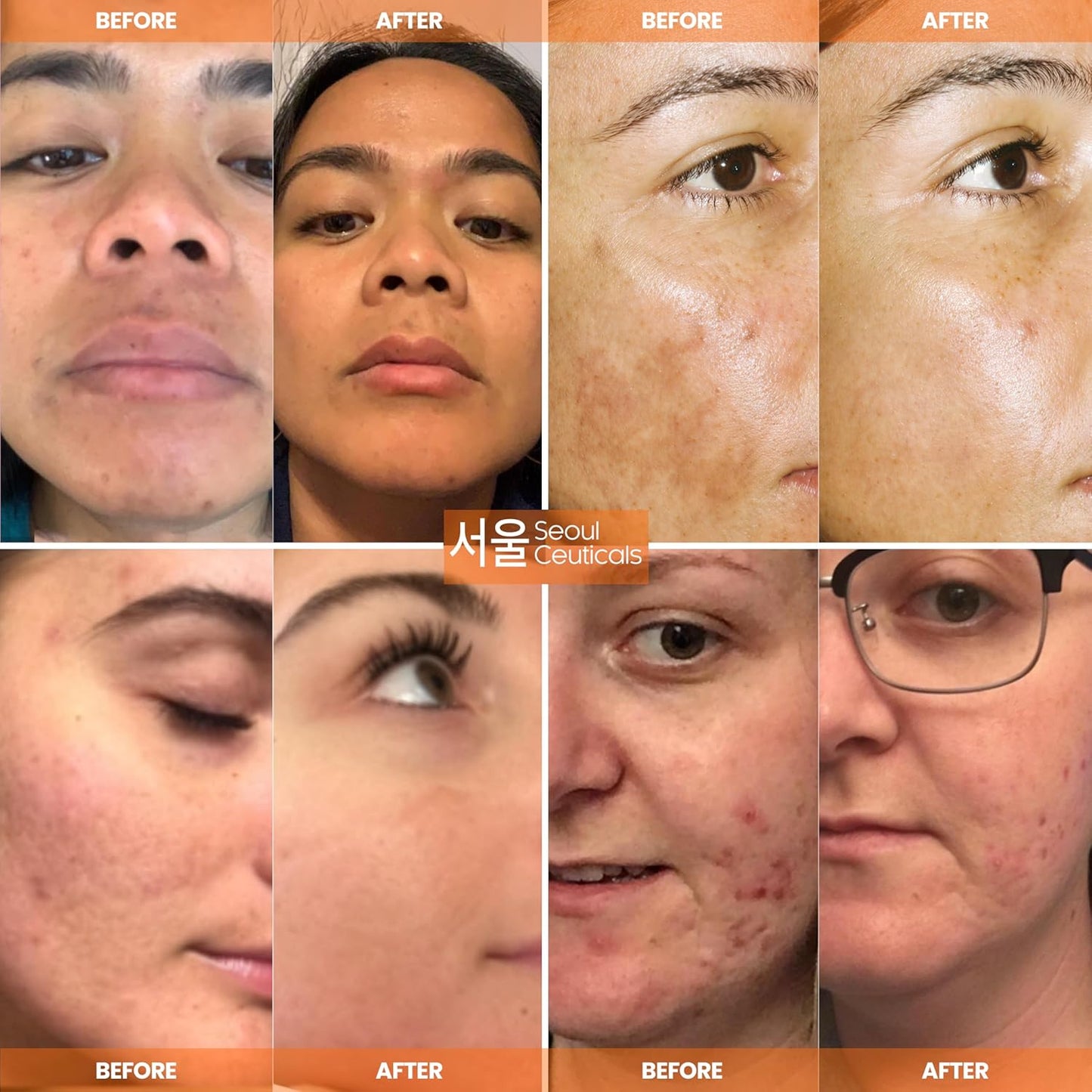 SeoulCeuticals Gran suero coreano de 2 onzas con 20% de vitamina C...