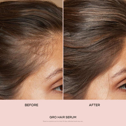 VEGAMOUR GRO Hair Serum for Hair Thinning &amp; Shedding, Thicker F...